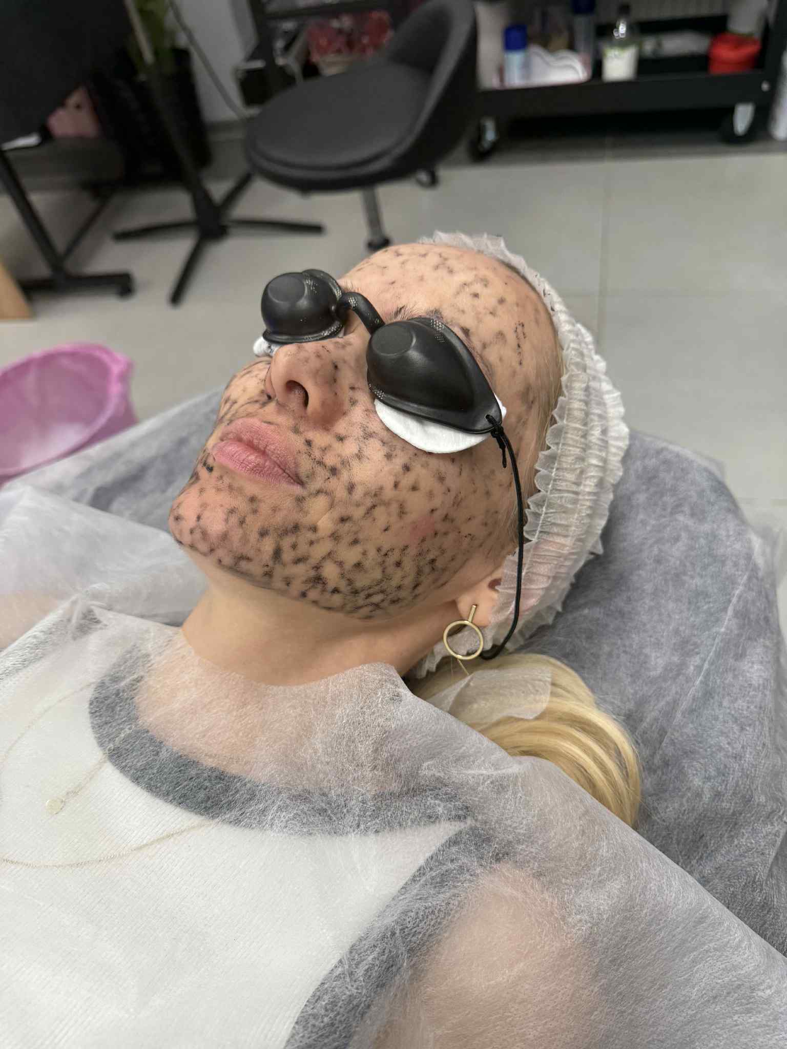 Zabiegi laserowe Chorzele