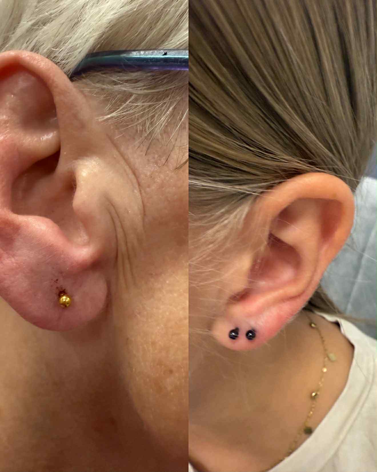 Przekłuwanie uszu Przasnysz